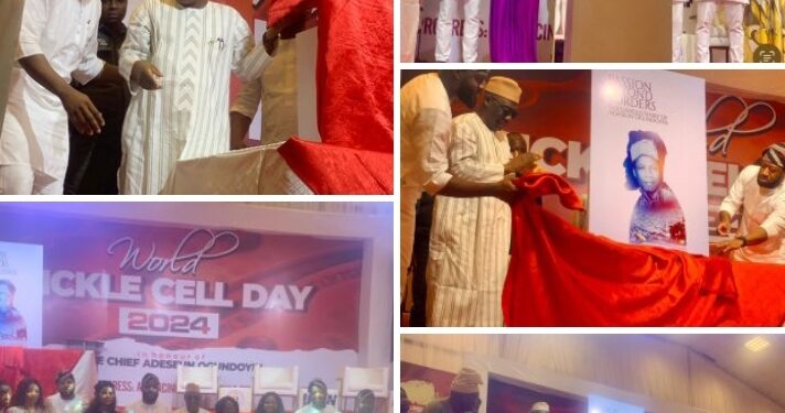 Ogundoyin was a dogged fighter*— Oyo Deputy Gov   ..says no condition should define a human being