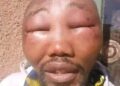 APC Ward Chairman Beaten Beyond Recognition in Kebbi State While Preaching Tinubu’s Achievements.