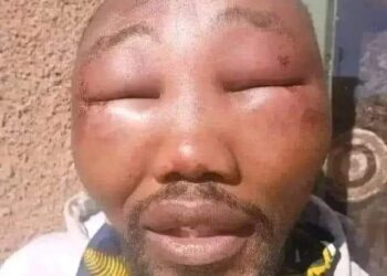 APC Ward Chairman Beaten Beyond Recognition in Kebbi State While Preaching Tinubu’s Achievements.