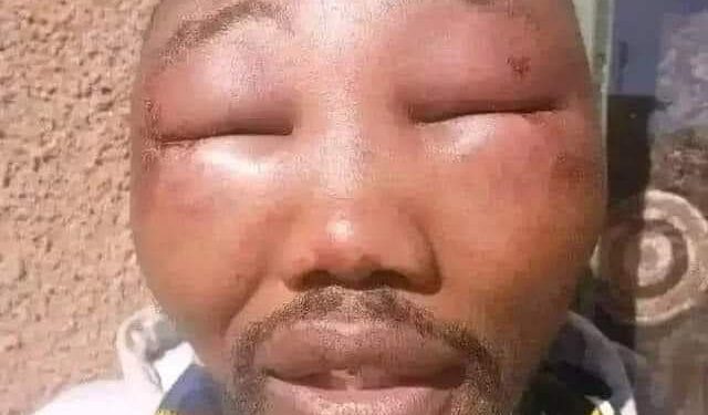 APC Ward Chairman Beaten Beyond Recognition in Kebbi State While Preaching Tinubu’s Achievements.